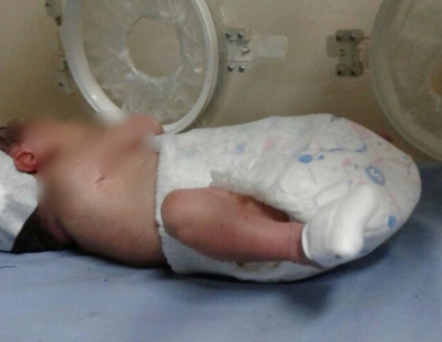 Bayi yang dibuang di sungai hidup-hidup ditemukan di Pasar Kemis, Kabupaten Tangerang, Minggu (26/3/2017).