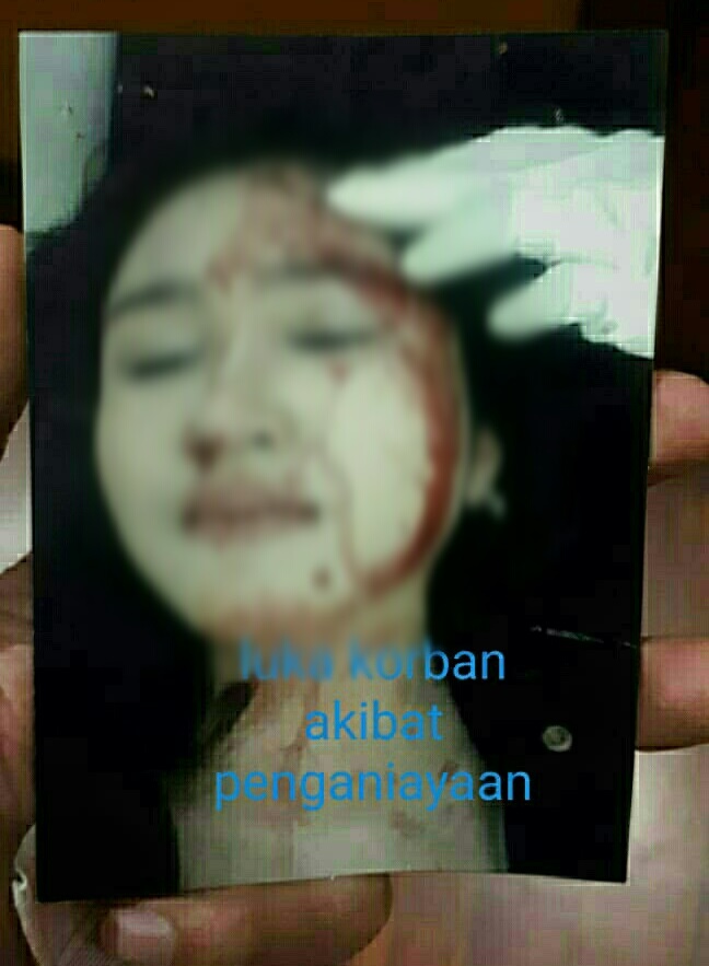 Korban penganiayaan.