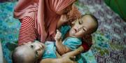 Ardi & Ardan, Bayi Kembar Siam di Tangerang Butuh Dukungan