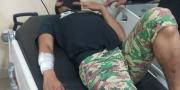 Korban Pengeroyokan Pemuda Mabuk di Ciputat Harus Jalani Operasi Tendon